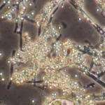 Microorganismos en fertilizantes e insecticidas