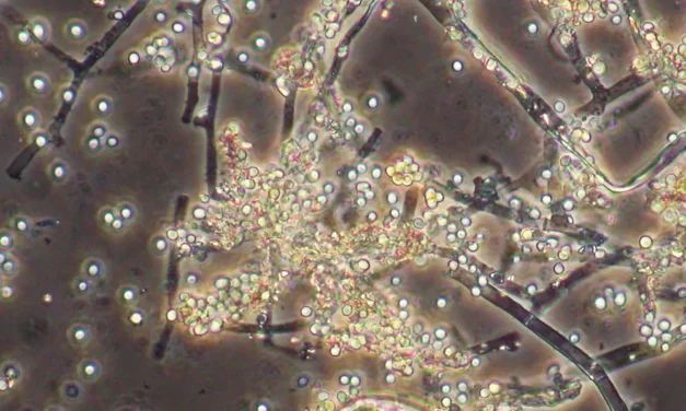 Microorganismos en fertilizantes e insecticidas