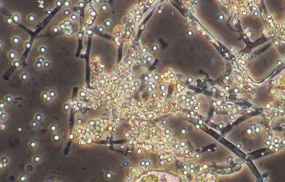 Microorganismos en fertilizantes e insecticidas