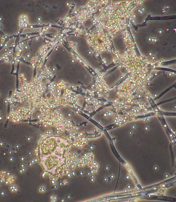 Microorganismos en fertilizantes e insecticidas